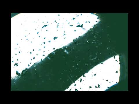 MERCURY DETOX | SCALAR ENERGY FIELD