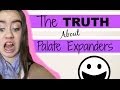 The Truth About Palate Expanders || Elise Renae ...