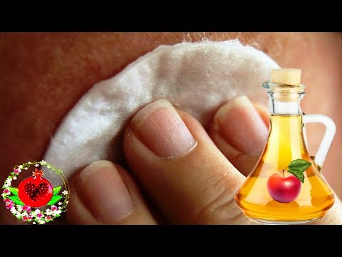 Отбеливание кожи лимон и петрушка Красивое лицо без веснушек