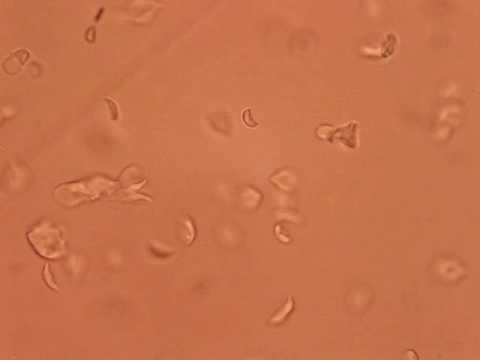 Come striscia vivo in un corpo umano Uovo di un parassita in Calais