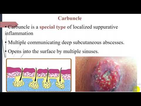 fruncle & carbuncle   7 DUM