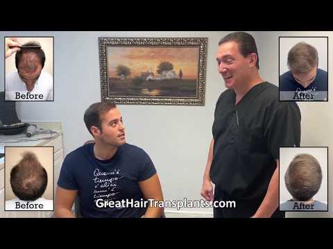 Dr. Brett Bolton Patient Giorgio MaxHarvest Plus 





