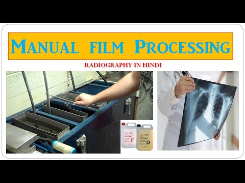 Laser Medical X Ray Film for Hospital Anu Medical Distributors