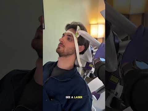 TMS Brain Mapping at Allen Psychiatry! #tms #transcranialmagneticstimulation