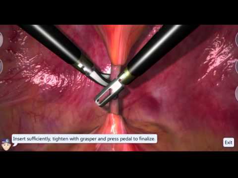 Catheter Insertion • Video • MEDtube.net