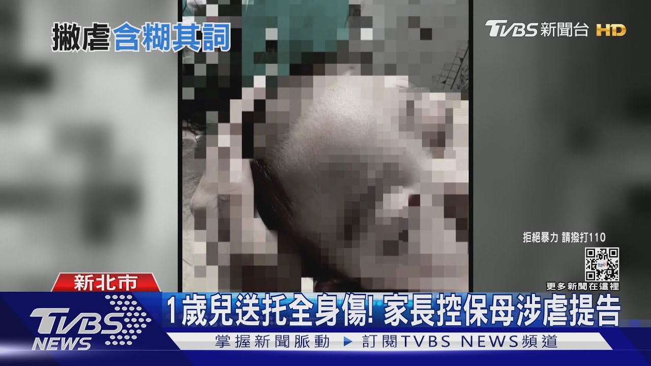 1歲兒送托全身傷！　家長控保母涉虐提告