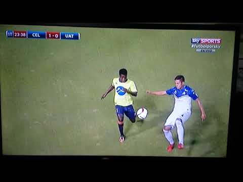 CELAYA VS CORRECAMINOS LESÃO DE ABRAM RIESTRA
