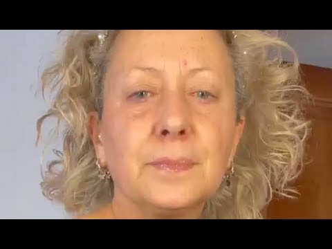 Carolyn Smith e il messaggio di dolore per l'agguato al cane Mikee: "Non può essere operato" Durante