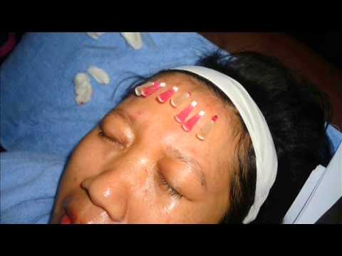 Cara menurunkan berat badan Lolita Penurunan berat badan ulasan tentang melon