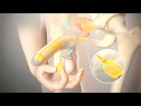Prostata Reisepreis Behandlung von Prostata-Adenom dArsonval