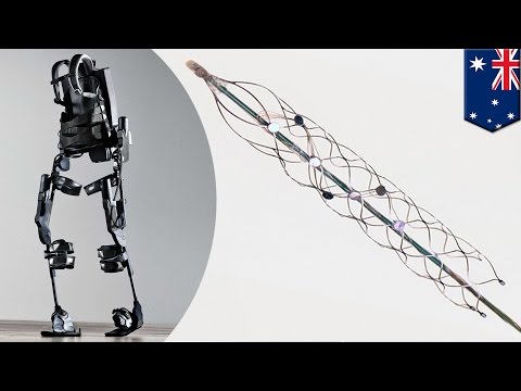 download lagu mp3 mp4 Bionic Spine Australia, download lagu Bionic Spine Australia gratis, unduh video klip Bionic Spine Australia