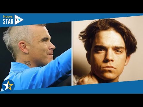 'Losing my hair!' Robbie Williams agonises as his locks are getting 'thinner and thinner'