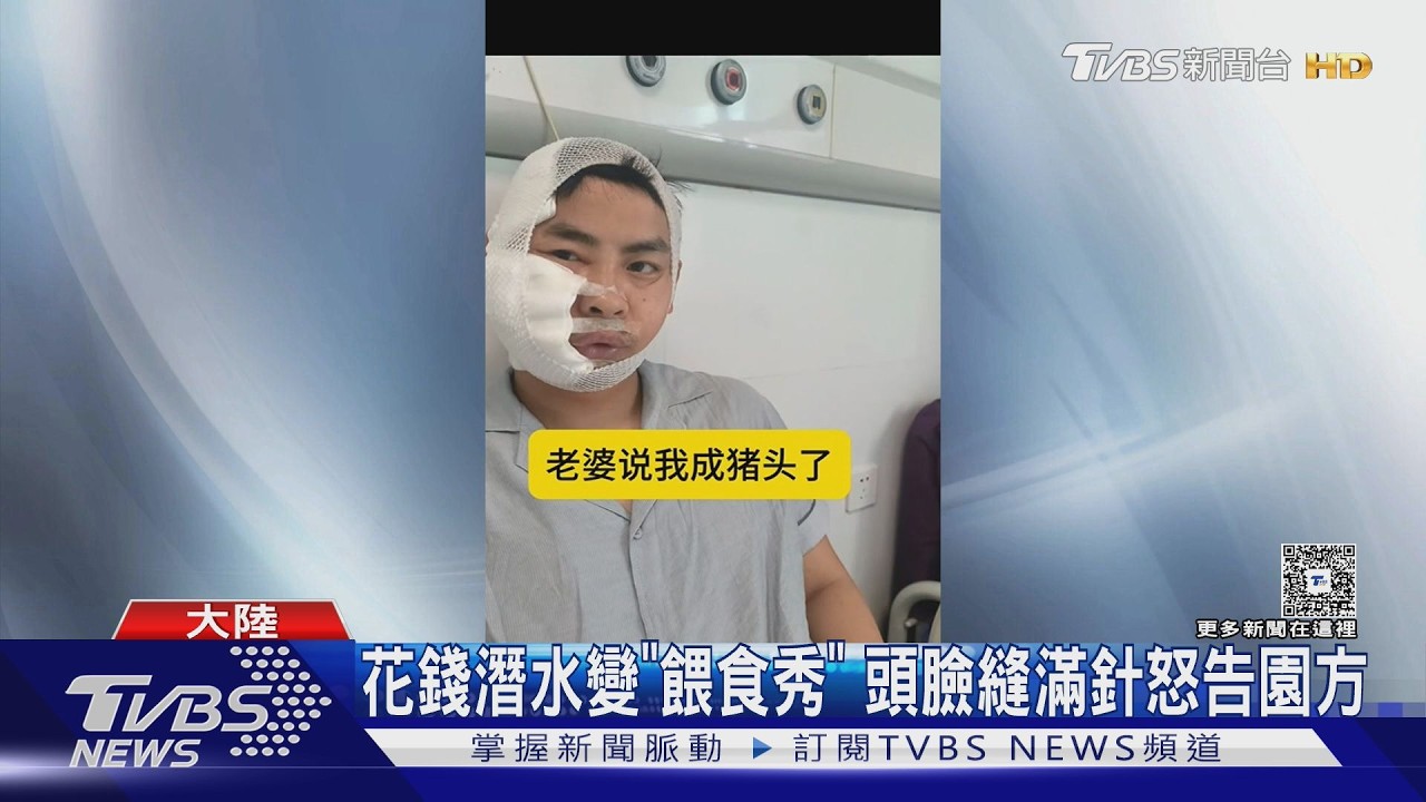律師體驗潛水「秒遭虎鯊狠咬」!臉縫滿針毀容 妻全程目睹崩潰