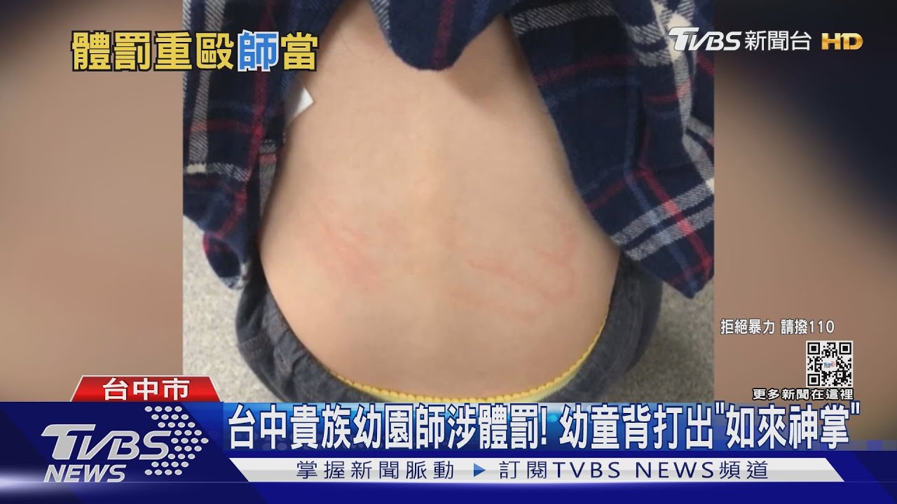 台中貴族幼園師涉體罰! 幼童背打出「如來神掌」