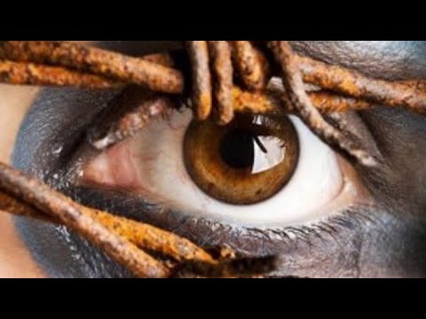 Për sa kohë mund të shërohet mësyshi te njeriu? - Dr. Imam Ahmed Kalaja