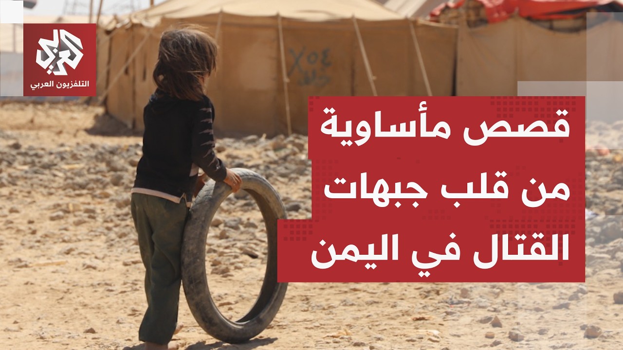 نار الحرب تأكل الأخضر واليابس في اليمن والنزوح يتصاعد من جبهات المواجهة المس