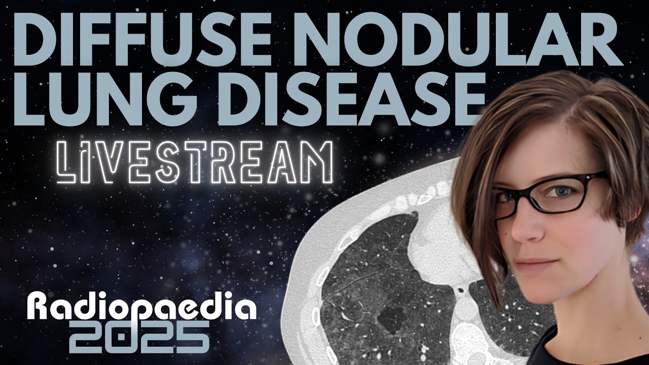 Diffuse nodular lung diseases with Miranda Siemienowicz