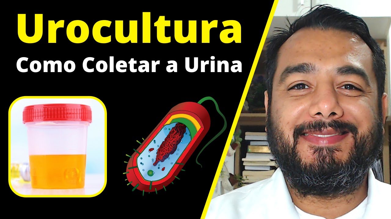 Exame de urocultura (cultura de urina): como fazer a coleta de urina? | Urocultura qual o preparo?