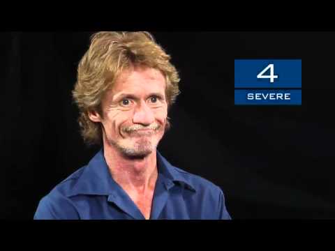 Drug-Induced Movement Disorders: DISCUS Sample