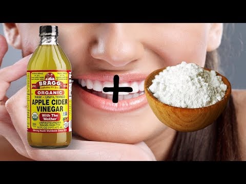 download lagu mp3 mp4 Clean Teeth With Baking Soda And Vinegar, download lagu Clean Teeth With Baking Soda And Vinegar gratis, unduh video klip Clean Teeth With Baking Soda And Vinegar