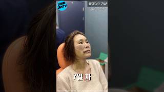 바디 리프트 성형 시술