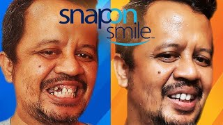 Download lagu SNAP ON SMILE | CARA MUDAH MEMBUAT VENER GIGI SENDIRI DI RUMAH mp3 Download lagu SNAP ON SMILE | CARA MUDAH MEMBUAT VENER GIGI SENDIRI DI RUMAH mp3