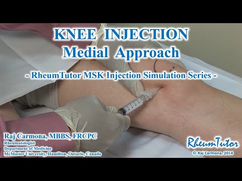 KNEE ASPIRATION / INJECTON - MEDIAL APPROACH: Step-By-Step Teaching Simulation