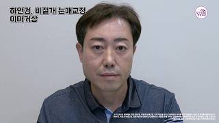 중년 눈밑지 | #하안검 #이마거상 으로 똘망똘망한 눈매