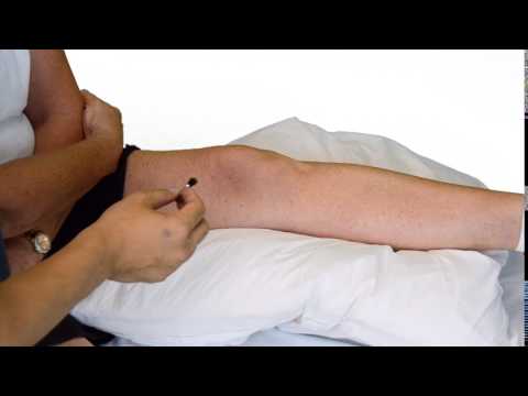 Quantitative sensory testing   dynamic allodynia