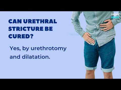 Urethral Stricture- Frequently Asked Questions