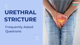 Urethral Stricture - Frequently Asked Questions