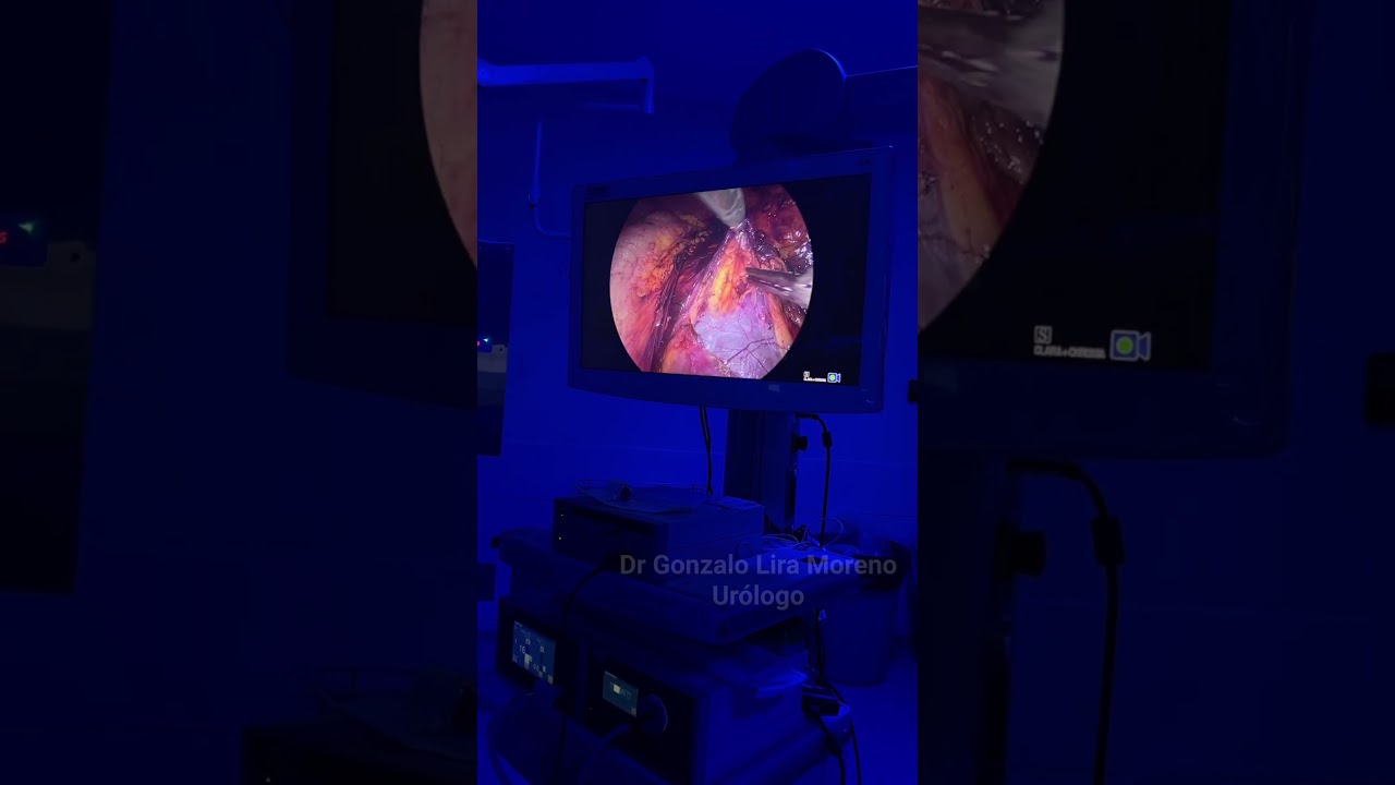 Gonzalo Lira Moreno-14