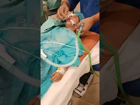 Critical patient in ICU Unit // patient on ventilator in ICU #medical #infromation #icucare