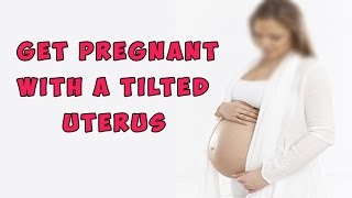 Learn How to Get Pregnant With a Tilted Uterus