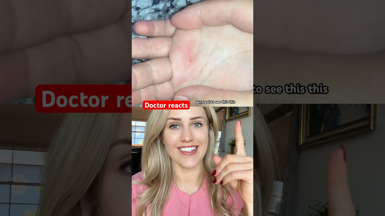Doctor reacts: genius splinter life hack!