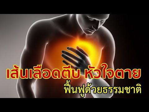 สูตรความแรงที่เพิ่มขึ้น ฉีดแรง