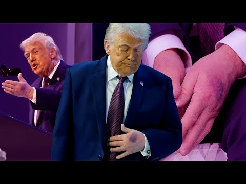 DONALD TRUMP está MURIENDO - ¿Qué Enfermedad tiene? - MAGNUS MEFISTO