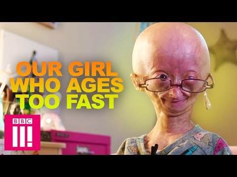 歳をとるのが早すぎる私たちの少女。アダリア・ローズ (Our Girl Who Ages Too Fast: Adalia Rose | Living Differently)