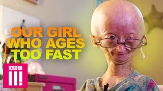 Our Girl Who Ages Too Fast: Adalia Rose | Living Differently