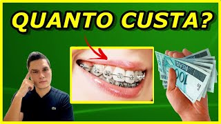 QUANTO CUSTA EM MÉDIA A MANUTENÇÃO DO APARELHO ORTODÔNTICO | VOCÊ NÃO VAI ACREDITAR NOS VALORES!!!