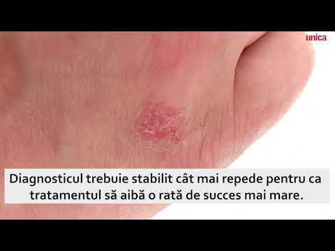 ce poate afecta durerea articulară