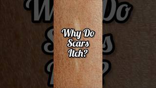 Why Do Scars Itch #beauty #skincare #science #skin #aesthetic #cosmetics #medicine #beautiful