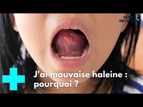 J'ai mauvaise haleine : pourquoi - Le Magazine de la Santé