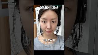 울쎄라 400샷 효과