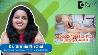 CLOGGED PORES - How to get rid of it?  - Dr. Urmila Nischal | Doctors