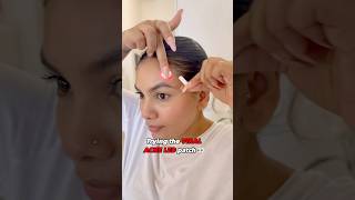 Electronic Acne patch 👀 | Acne gayab  in just 4 hours 😎 #acne #pimple #acnetreatment #shortsviral