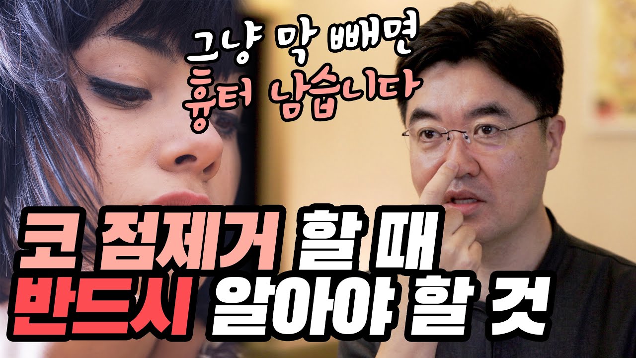 코점 제거가 어려운 이유와 흉터를 줄이는 방법 설명 영상 썸네일