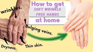 How to Stop AGING HANDS, Reduce Wrinkles, Dry, Thinning skin/ Hand Massages and Home remedies