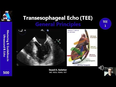 Transesophageal Echo (TEE)1- General Principles