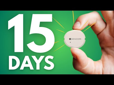 Dexcom G7 15-Tage-Studie erklärt